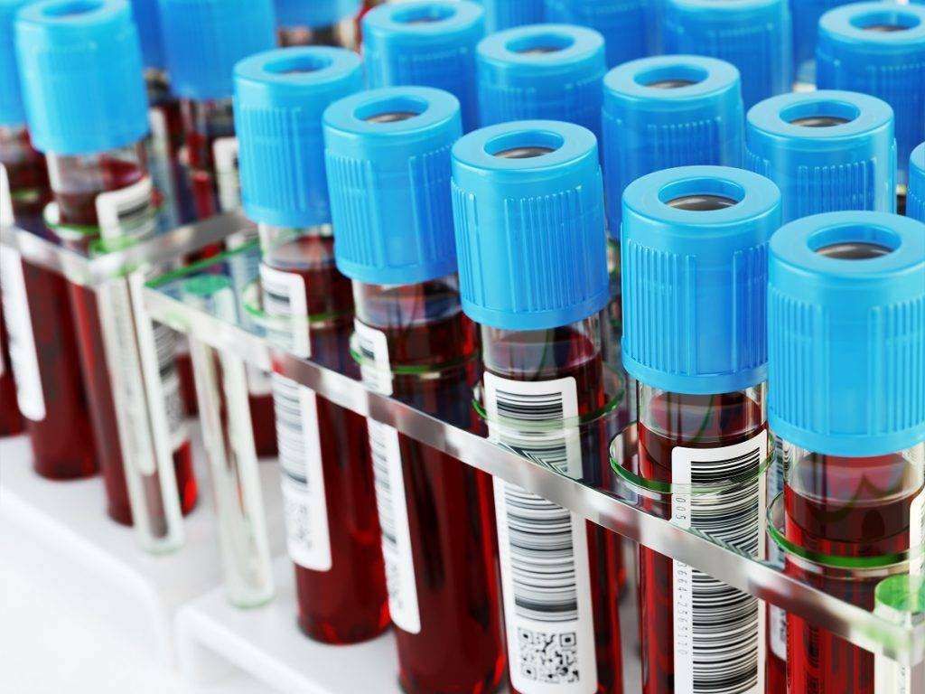 blood-vials